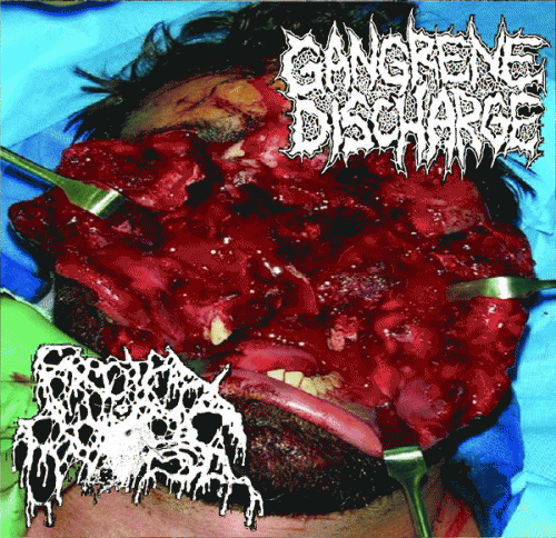 Gangrene Discharge : Gangrene Discharge - Rectal Prolapse